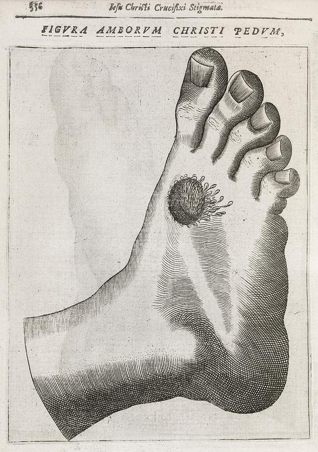 Christs Stigmata, 17th Century #2 Photograph by Science Photo Library Christs Stigmata, 17th Century #2 Photograph by Science Photo Library
