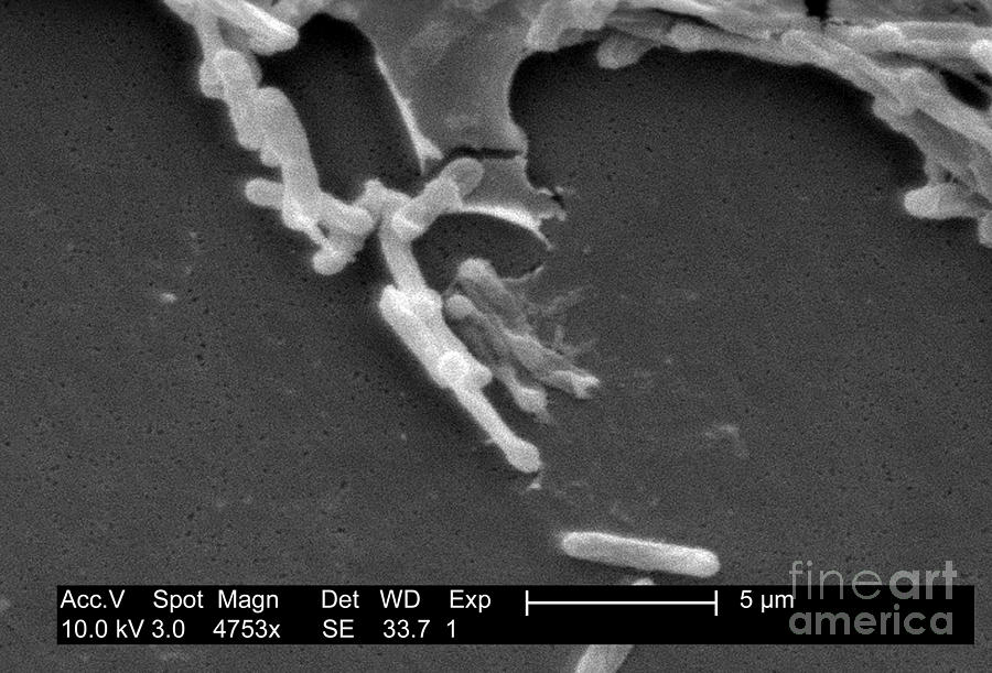Clostridium Difficile Bacteria, Sem #2 Photograph by Science Source