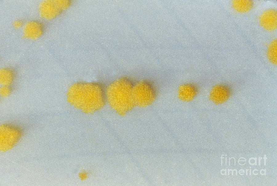 Clostridium Difficile #2 Photograph by Science Source