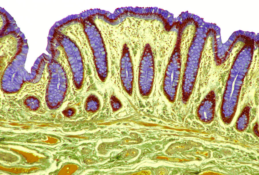 Colon Lining, Light Micrograph Photograph by Steve Gschmeissner - Fine ...