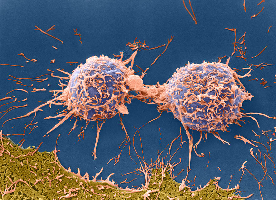 Cell Photograph - Coloured Sem Of Cervical Cancer Cells Dividing #2 by Steve Gschmeissner