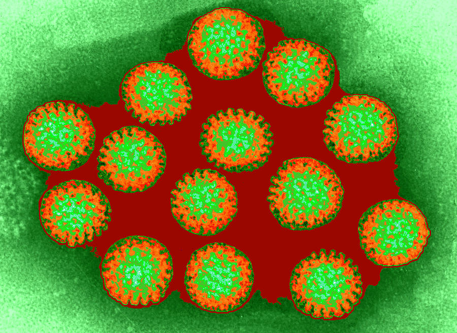 Coloured Tem Of A Group Of Rotaviruses Photograph By Dr Linda Stannard   2 Coloured Tem Of A Group Of Rotaviruses Dr Linda Stannard Uct 