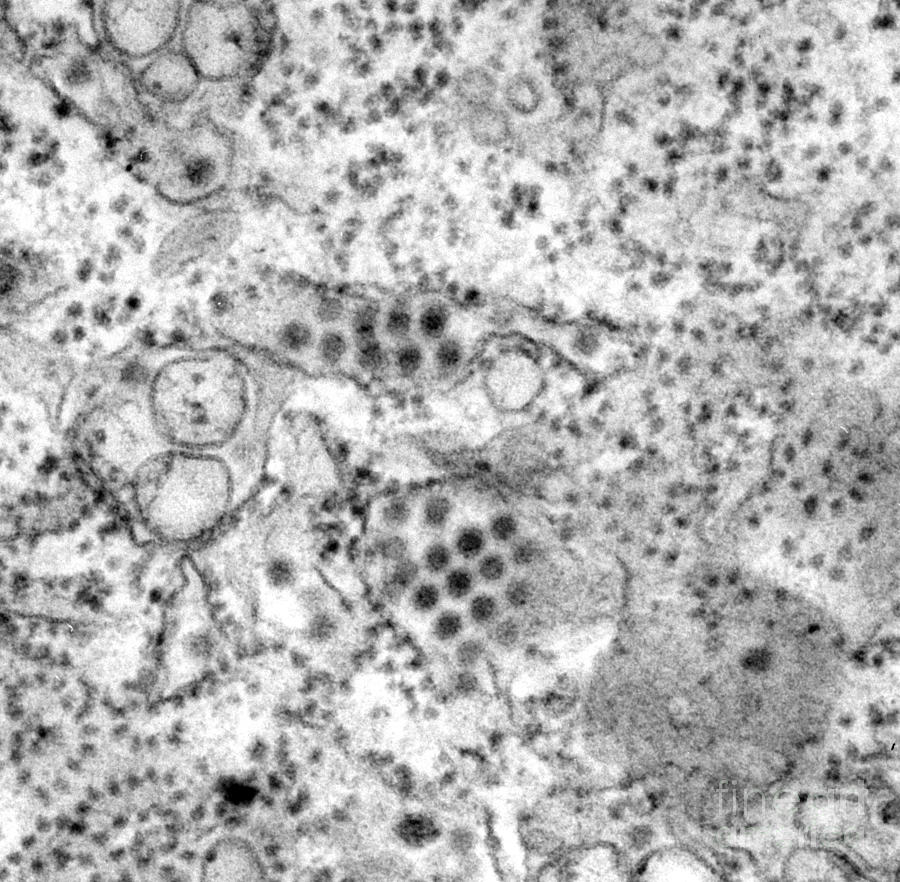Dengue Virus, Tem #2 Photograph by Science Source