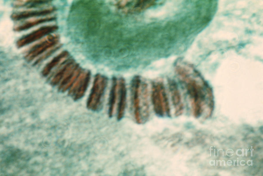 Chromosome Photograph - Drosophila Chromosome, Lm #2 by Omikron