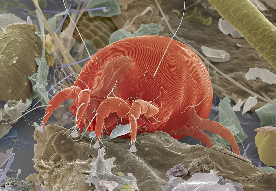 Wildlife Photograph - Dust Mite, Sem #2 by Power And Syred