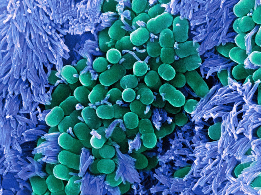 E. Coli Bacteria, Sem Photograph by Stephanie Schuller