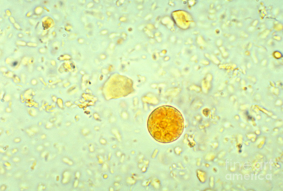 Entamoeba Histolytica Cyst #2 Photograph by Science Source