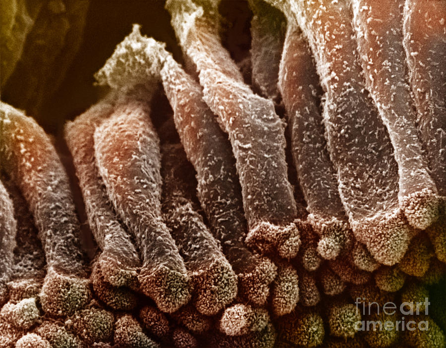 Epithelium Of The Gall Bladder #2 Photograph by Science Source