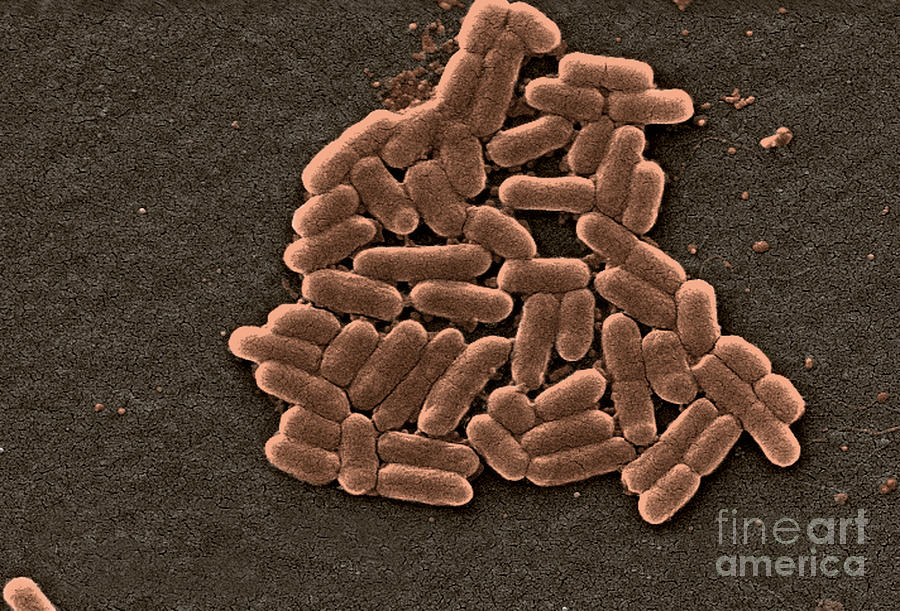 Escherichia Coli O157h7 Bacteria, Sem #2 Photograph by Science Source