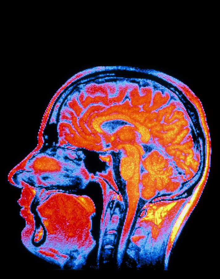 False-colour Nmr Scan Of The Head, Sagittal Slice Photograph by Cnri ...