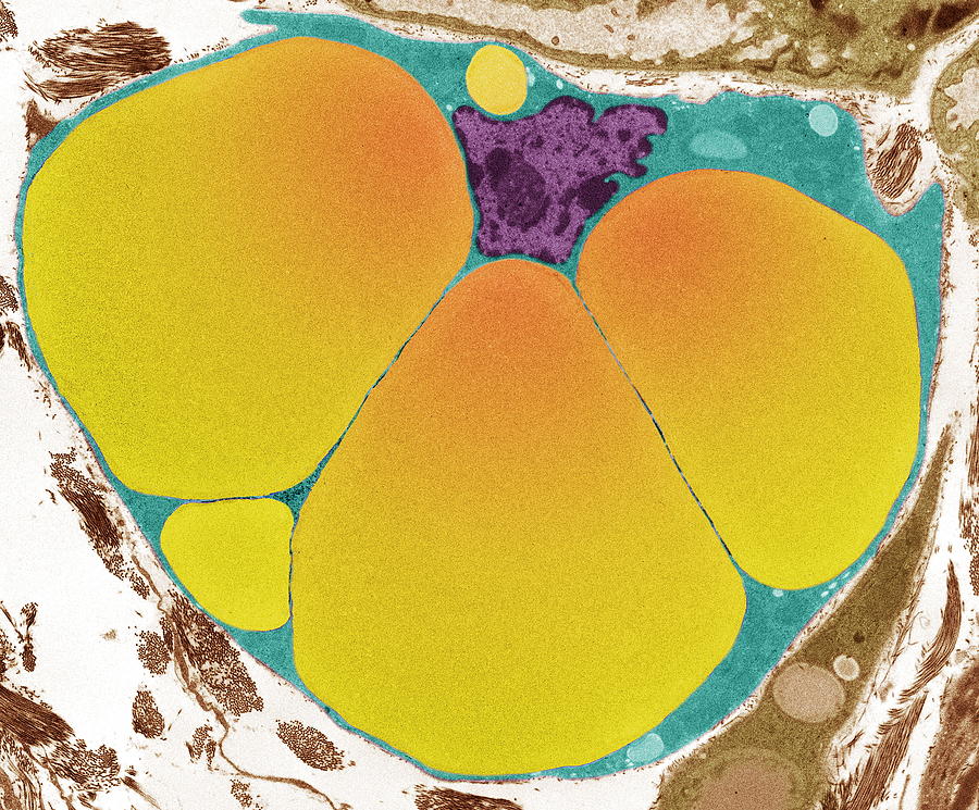 fat cell shape