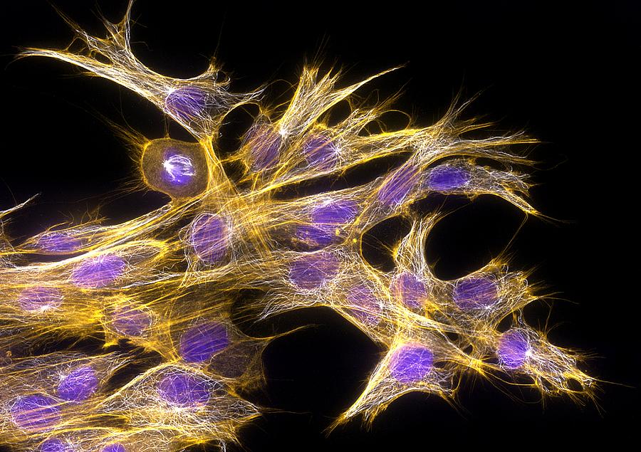 Fibroblast Cells, Fluorescent Micrograph #2 Photograph by Dr Torsten Wittmann