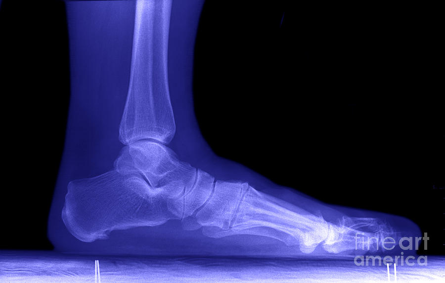 Foot X-ray #2 Photograph by Ted Kinsman