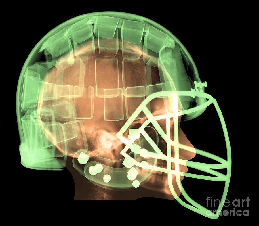 Football Helmet, X-ray #2 Photograph by Ted Kinsman