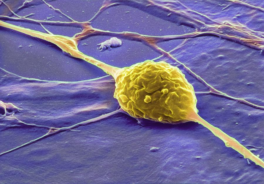Granule Nerve Cell, Sem #2 Photograph by David Mccarthy