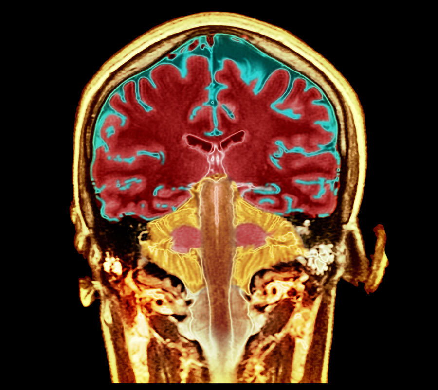 Healthy Human Brain Scan