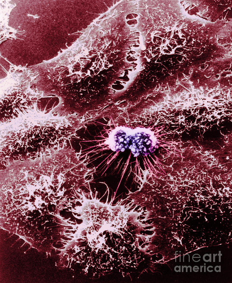 Hela Cells With Adenovirus #2 Photograph by Science Source