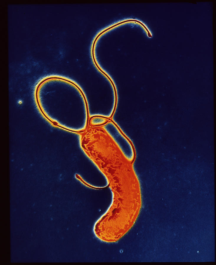 Helicobacter Pylori Photograph - Helicobacter Pylori Bacteria #2 by A.b. Dowsett