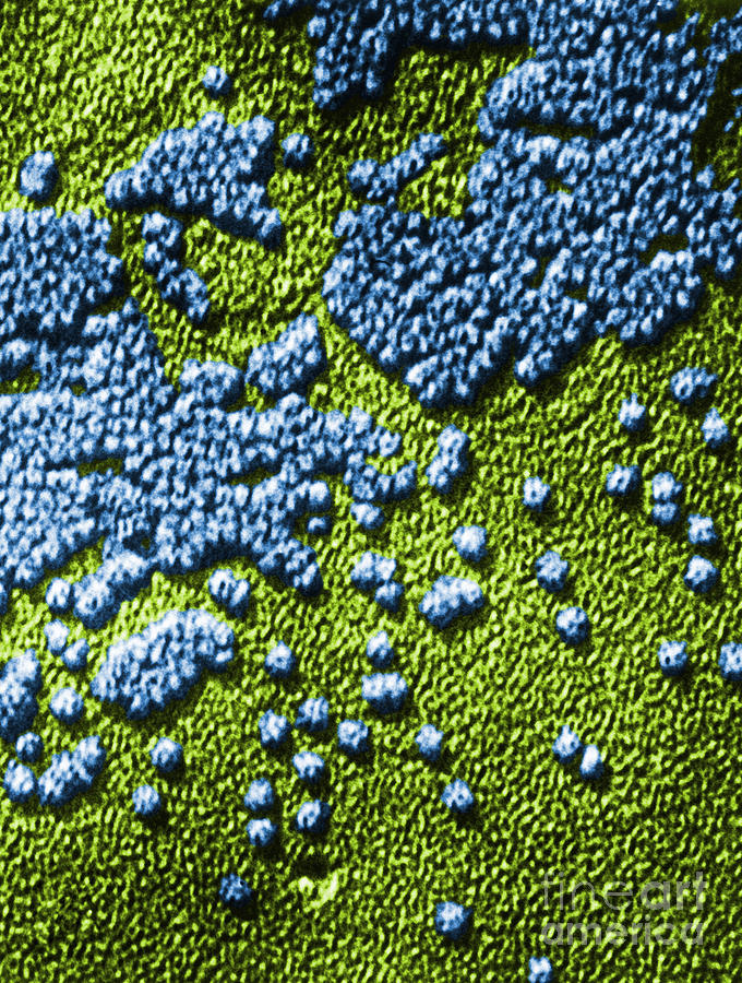 Hepatitis Virus #2 Photograph by Omikron