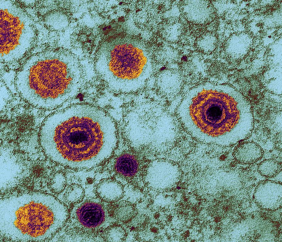 Herpes Virus, Tem Photograph by Dr Klaus Boller - Fine Art America