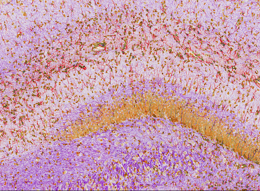 Hippocampus Brain Tissue #2 Photograph by Thomas Deerinck, Ncmir