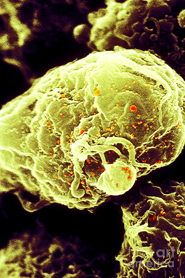 Hiv-1 Infected T4 Lymphocyte Sem #2 Photograph by Science Source