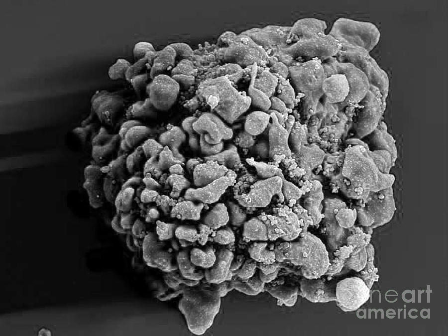 Microbiology Photograph - Hiv-infected H9 T Cell, Sem #2 by Science Source