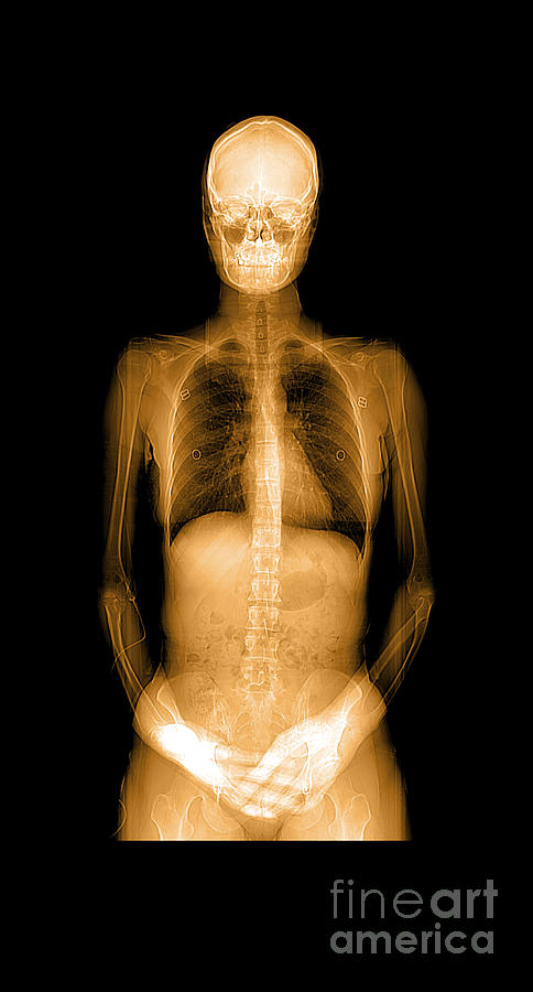Human Body X-ray And Ct #2 Photograph by Medical Body Scans