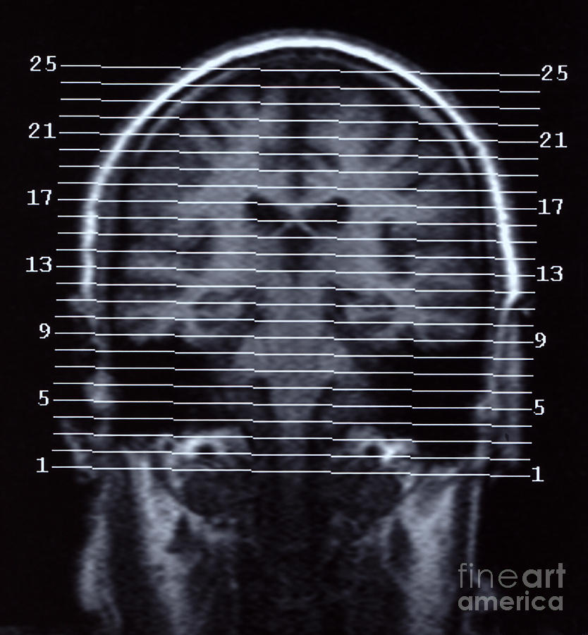 Human Brain #2 Photograph by Ted Kinsman
