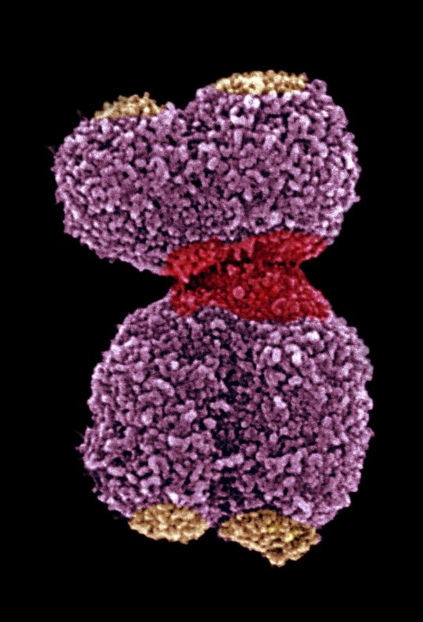 Human Chromosome 16, Sem #2 Photograph by 