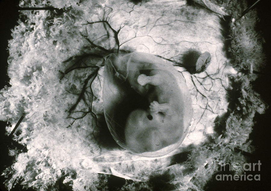 Human Embryo #2 Photograph by Omikron