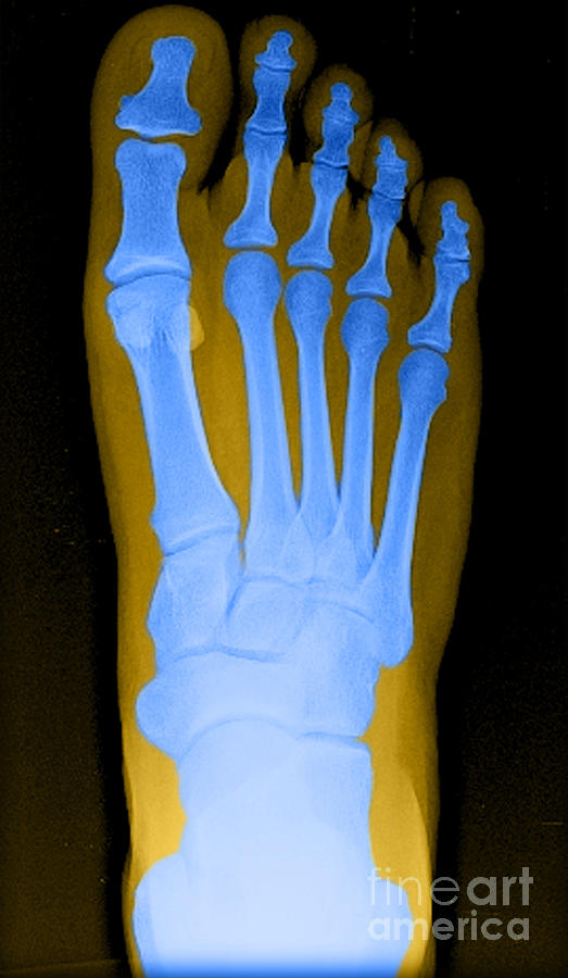 Human Foot #2 Photograph by Medical Body Scans