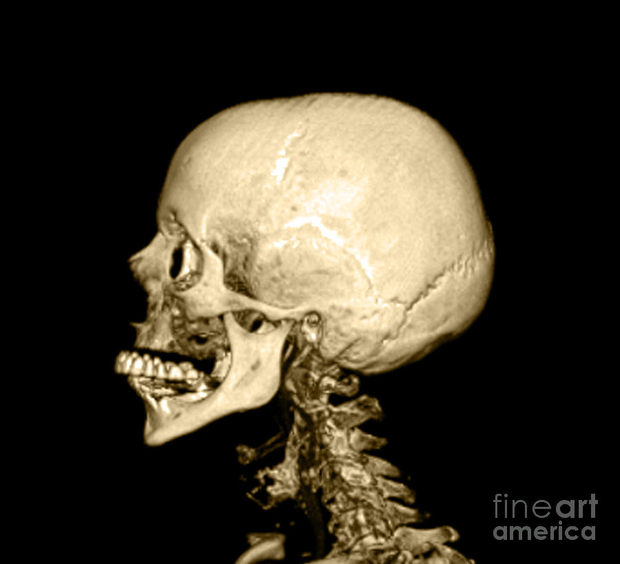 Human Skull #2 Photograph by Medical Body Scans
