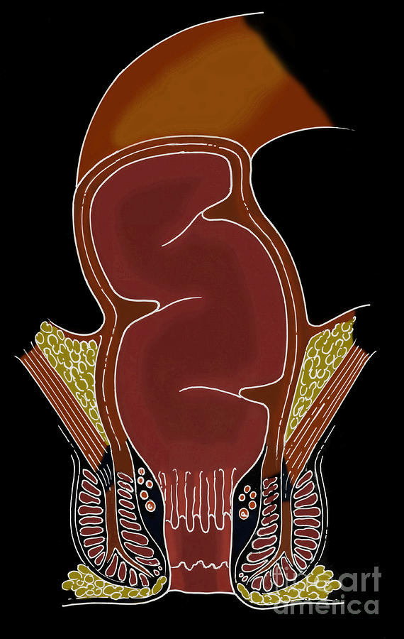 Illustration Of Rectum #2 Photograph by Science Source