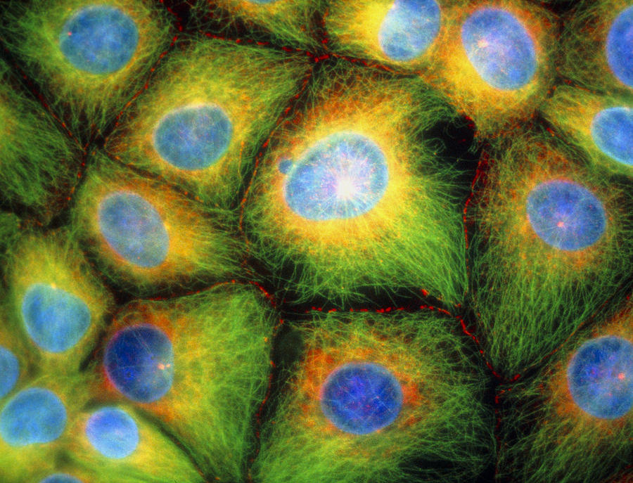 Images Photograph - Immunofluorescent Lm Of Squamous Carcinoma Cells #2 by Nancy Kedersha