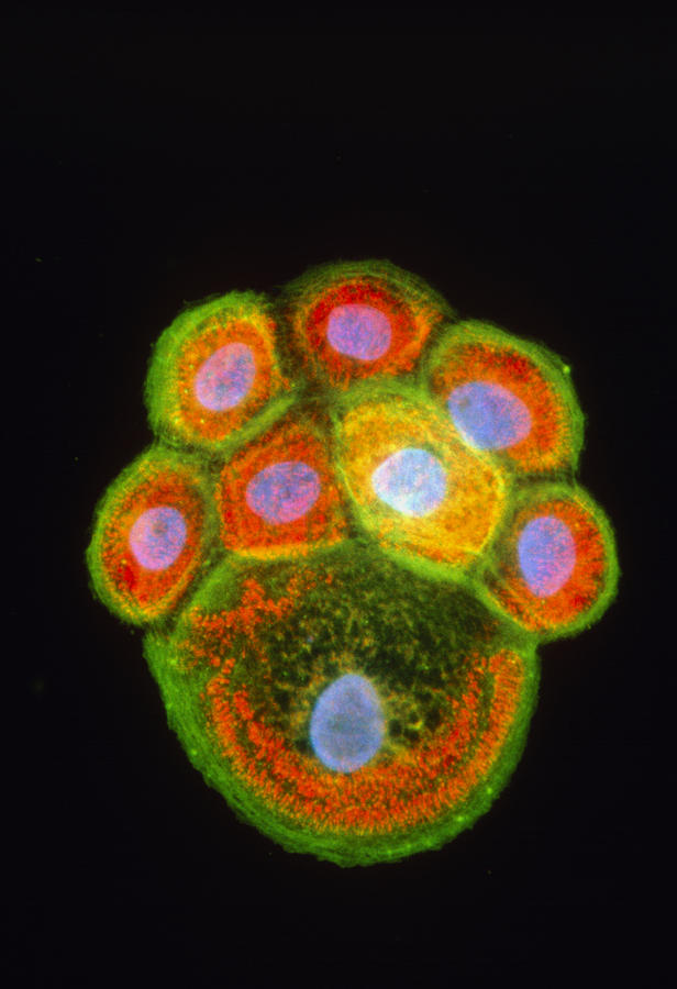 Cell Photograph - Immunofluorescent Lm Of Squamous Carcinoma Cells #2 by Nancy Kedershaimmunogen