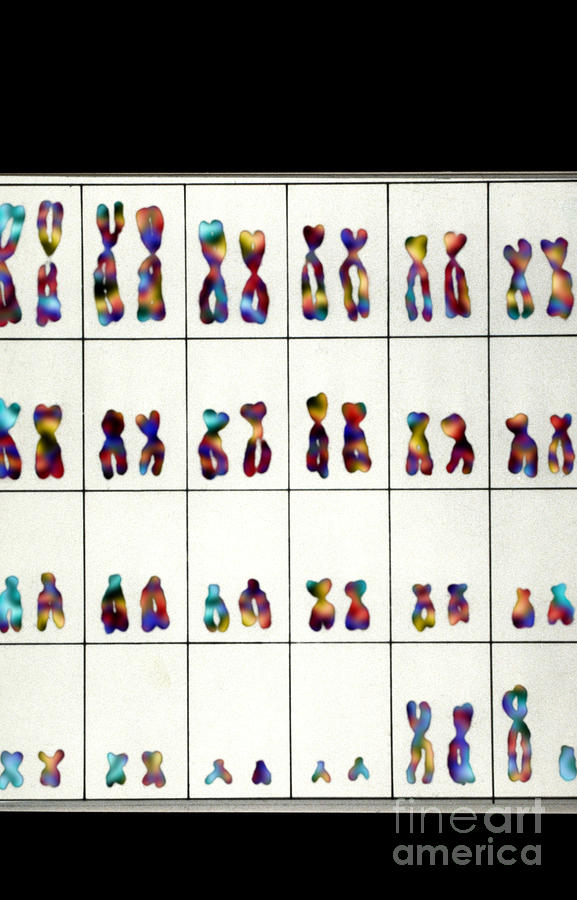 Karyotype Of Male Chromosomes #2 Photograph by Omikron