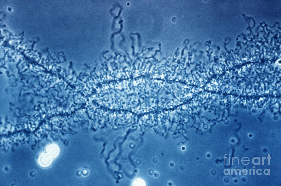 Lampbrush Chromosome #2 Photograph by Omikron