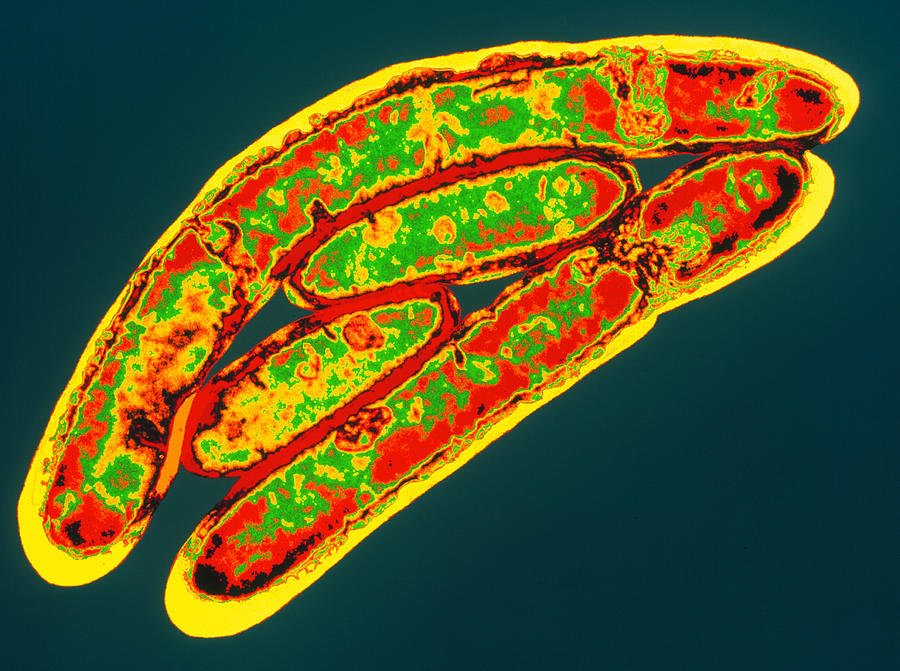 Legionella Bacteria Photograph By Dr Linda Stannard, Uct