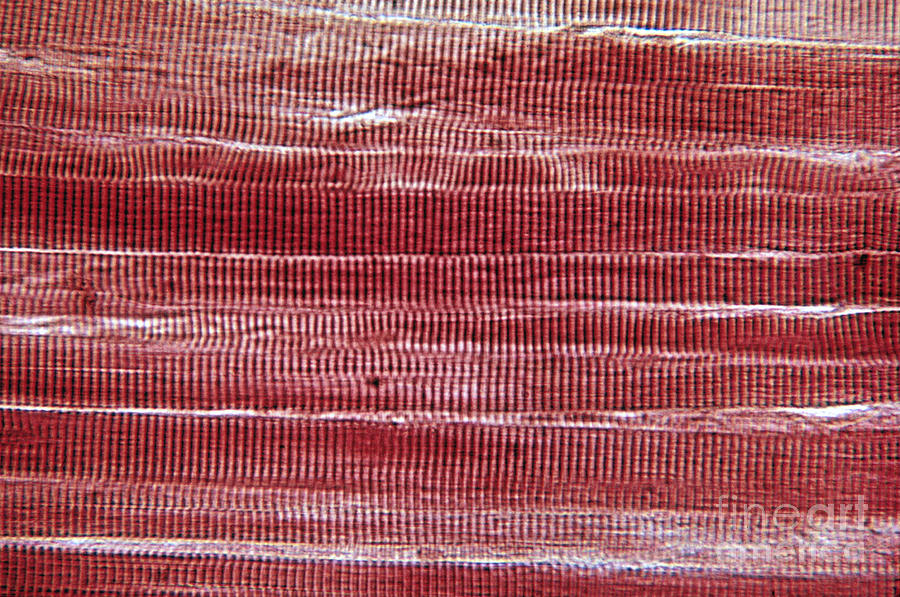 Lm Of Skeletal Muscle #2 Photograph by Eric V. Grave