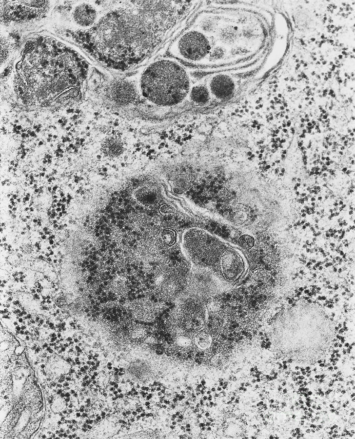 Lysosomes, Tem #2 Photograph by Science Source
