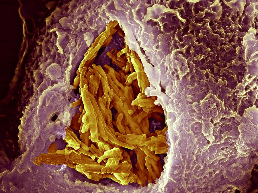 Mycobacterium Bovis Photograph - Macrophage Engulfing Tuberculosis Vaccine #2 by 