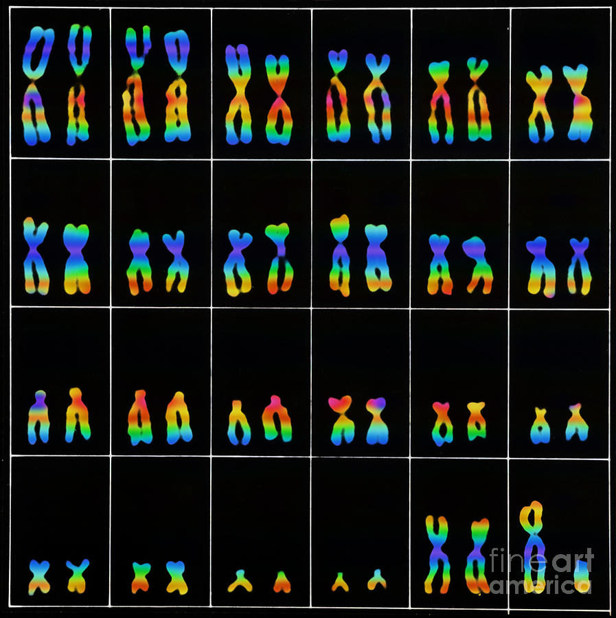 Chromosome Photograph - Male Karyotype #2 by Omikron