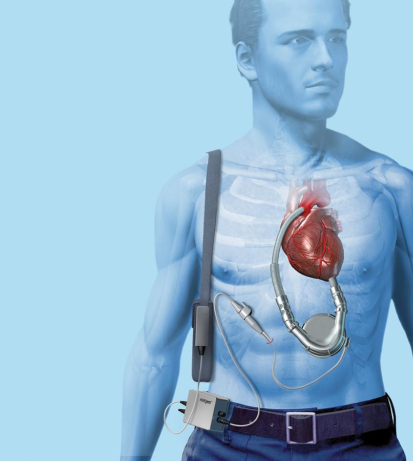 Battery Photograph - Mechanical Heart Pump, Artwork #2 by Henning Dalhoff