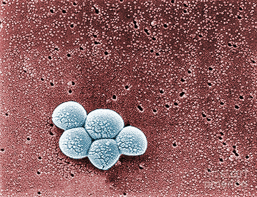 Methicillin-resistant Staphylococcus #2 Photograph by Science Source