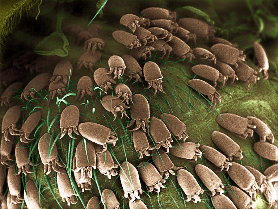 Mites On A Honeybee, Sem Photograph by London School Of Hygiene ...