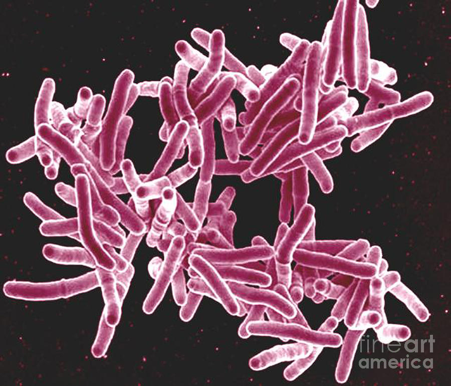 Microbiology Photograph - Mycobacterium Tuberculosis Bacteria, Sem #2 by Science Source