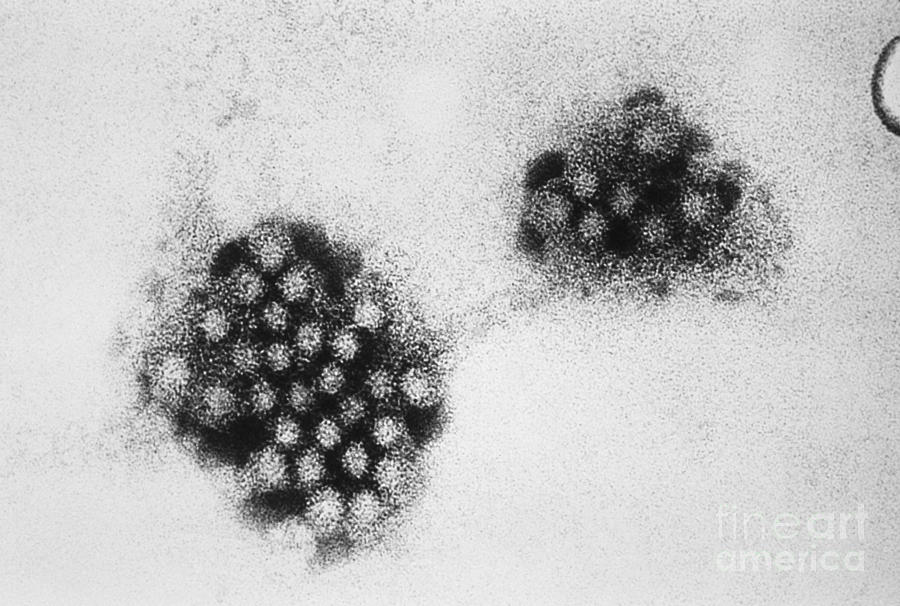 Norwalk Virus Photograph - Norwalk Virus, Tem #2 by Science Source