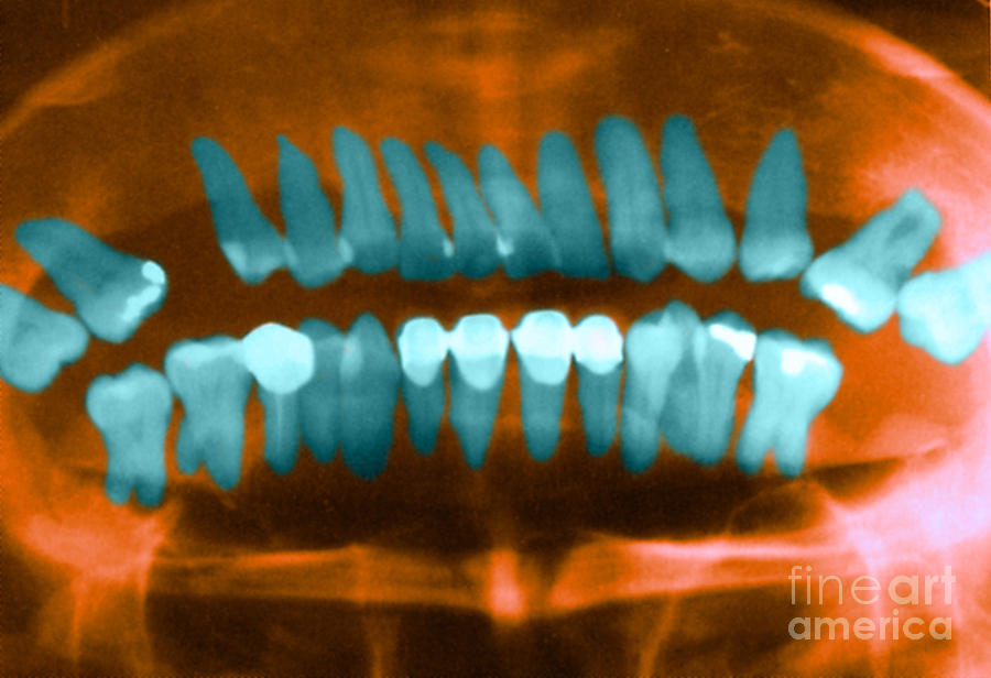 Panoramic Dental X-ray #3 Photograph by Science Source