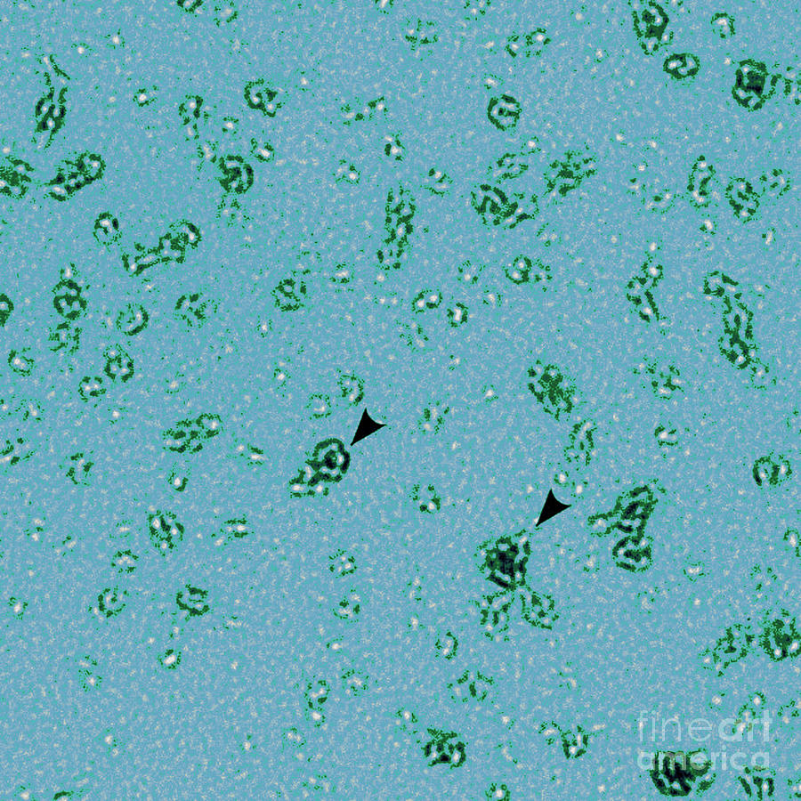 Microbiology Photograph - Pmpd Protein, Chlamydia Trachomatis #2 by Science Source